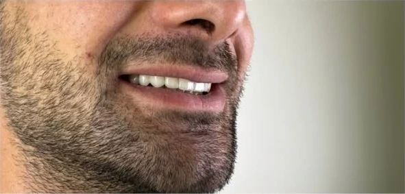 კბილების ფოტოები 2